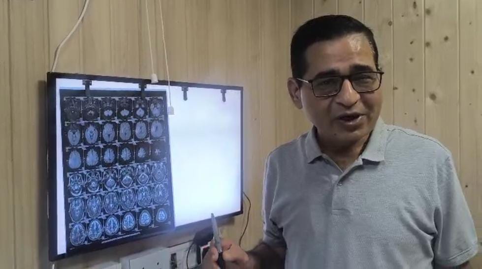 ब्रेन स्ट्रोक के मामले बढ़े, अब युवाओं में भी दिख रहा खतरा।